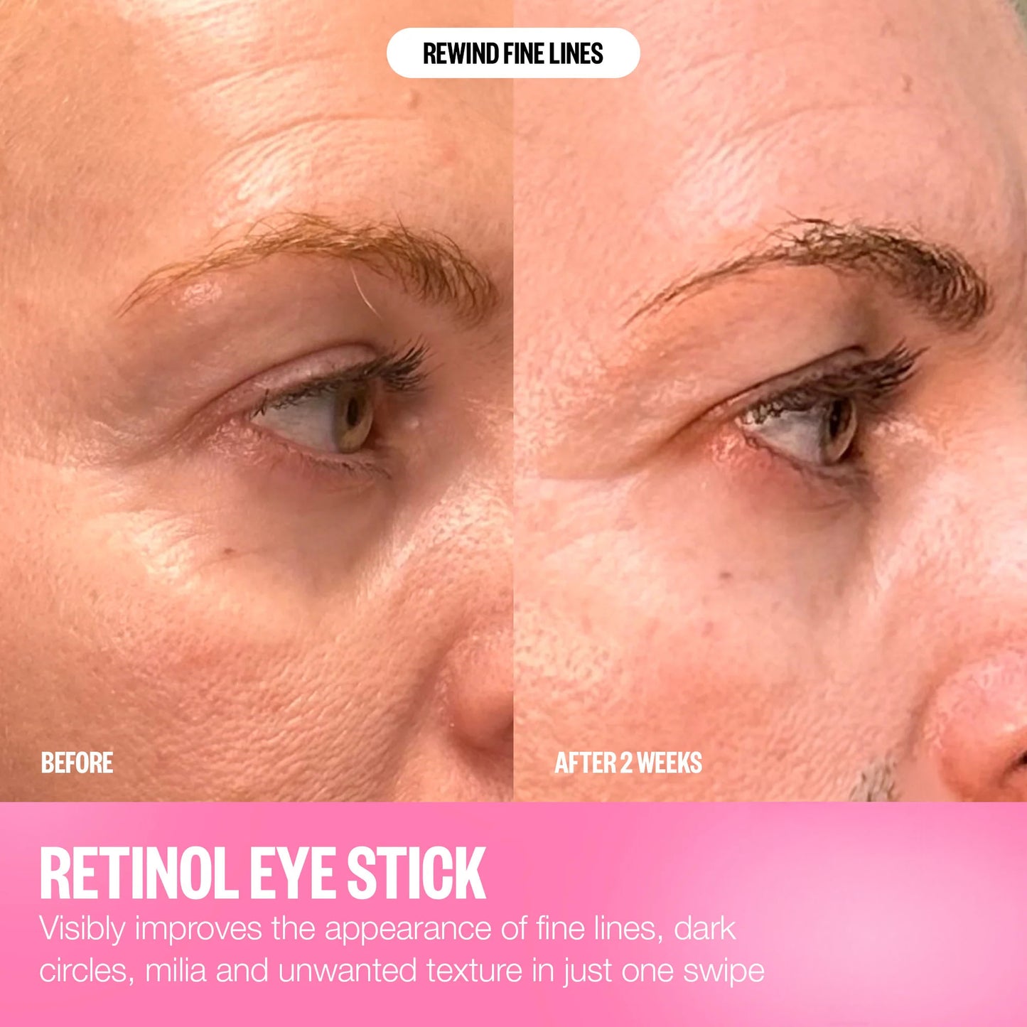 Retinol Eye Cream Stick